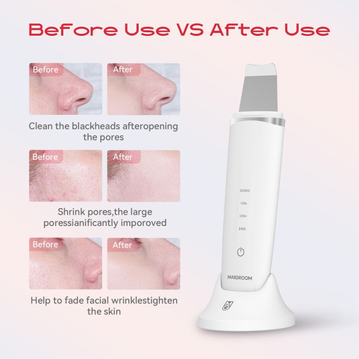 MAXGROOM M-169 ultrasonic cavitation peeling device with LED light therapy - white
