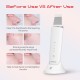 MAXGROOM M-169 ultrasonic cavitation peeling device with LED light therapy - white